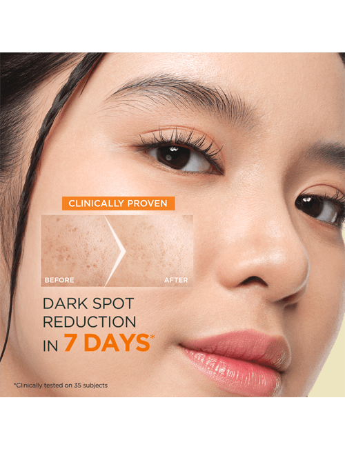 GARNIER SKINACTIVE FAST BRIGHT VIT C WATER GEL 50ML – Image 4