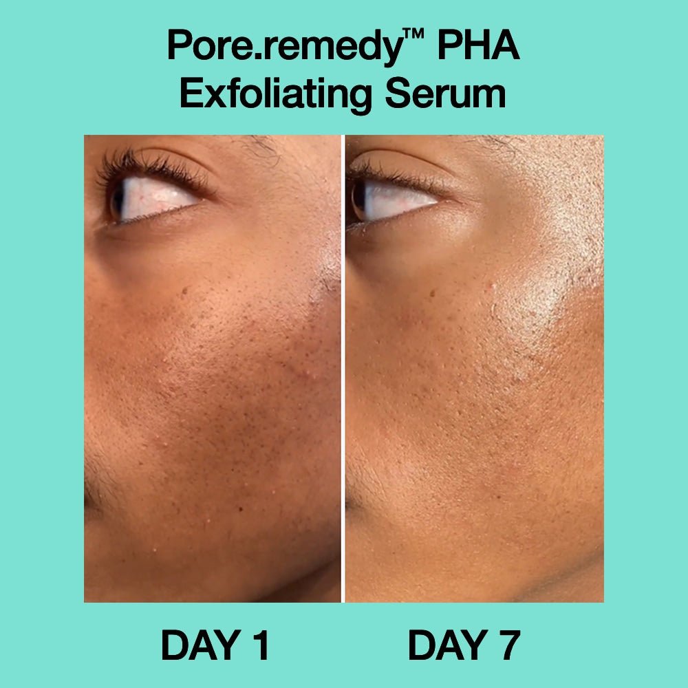 Dr jart+ PORE REMEDY™ - SÉRUM EXFOLIANT PHA 30ml – Image 2
